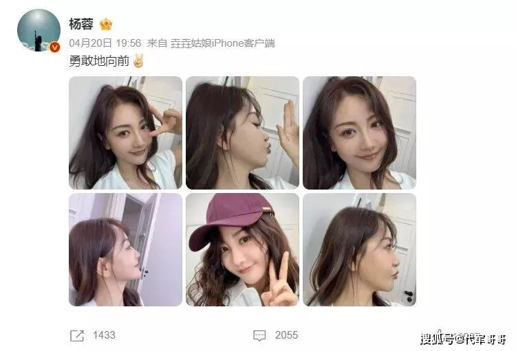 44岁杨蓉近况曝光!晒面部烫伤恢复照片上热搜